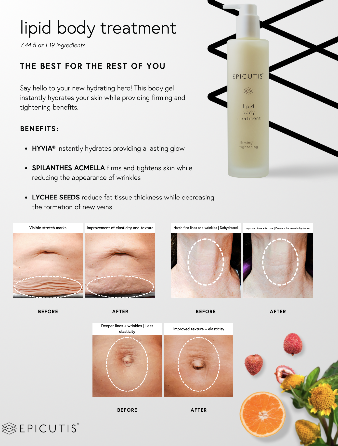 Epicutis Lipid Body Moisturizer
Lipid Restore Body Treatment
Advanced Lipid Body Cream
Deep Nourishing Body Treatment
Skin Barrier Body Treatment
Intensive Lipid Hydration Lotion
Nourishing Body Recovery Treatment
Lipid Luxe Body Moisturizer
Restorative Body Hydration Treatment
Ultra-Nourishing Lipid Body Care