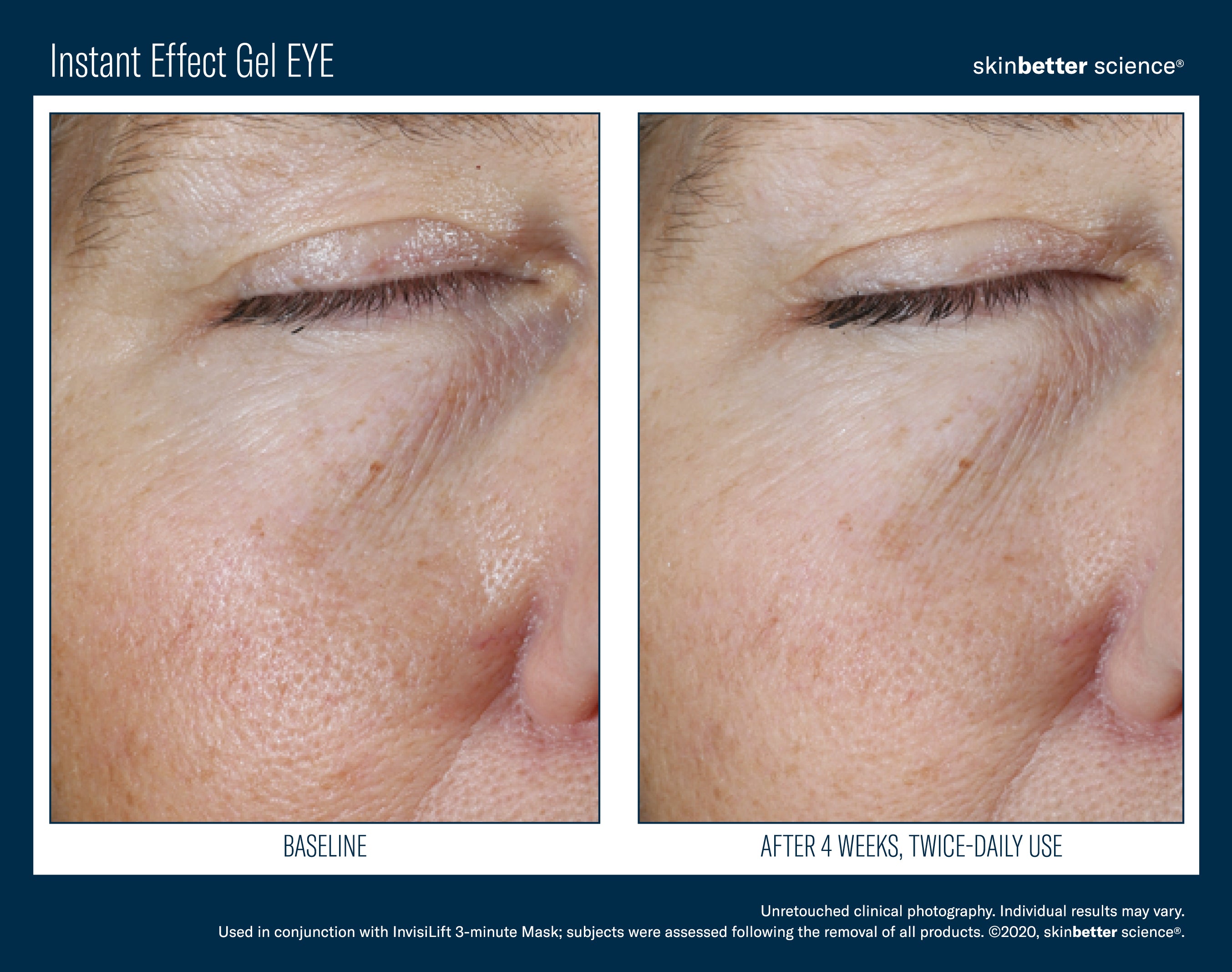 Instant Lift Smoothing Gel

Rapid Firming Effect Gel

QuickLift Skin Perfecting Gel

Express Smoothing Treatment Gel

Instant Radiance Tightening Gel

FlashLift Eye & Face Gel

Immediate Glow Firming Gel

Rapid Renewal Smoothing Gel

Instant Youth Effect Gel

Skin Perfecting Express Gel