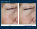 Instant Lift Smoothing Gel

Rapid Firming Effect Gel

QuickLift Skin Perfecting Gel

Express Smoothing Treatment Gel

Instant Radiance Tightening Gel

FlashLift Eye & Face Gel

Immediate Glow Firming Gel

Rapid Renewal Smoothing Gel

Instant Youth Effect Gel

Skin Perfecting Express Gel