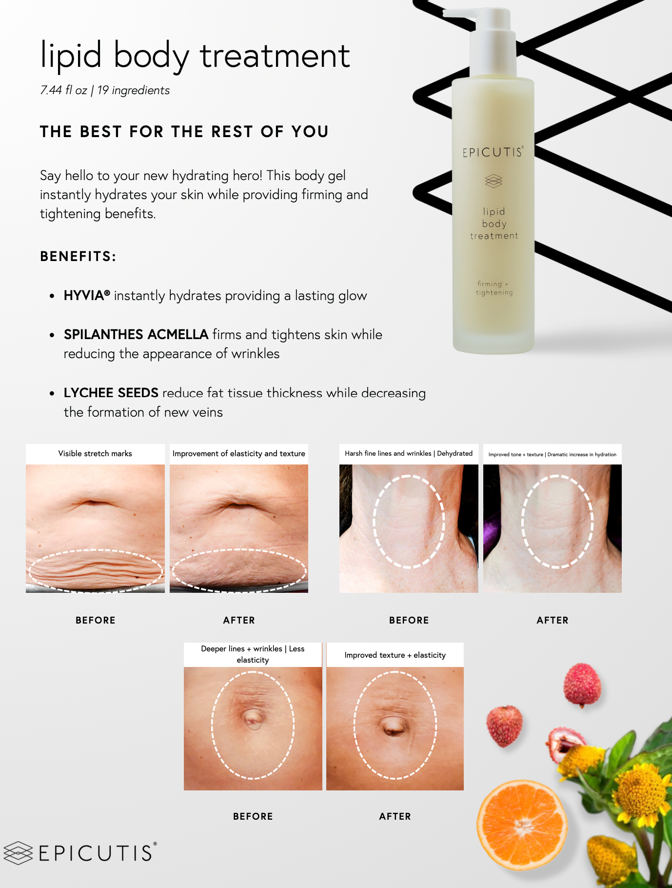 Epicutis Lipid Body Moisturizer

Lipid Restore Body Treatment

Advanced Lipid Body Cream

Deep Nourishing Body Treatment

Skin Barrier Body Treatment

Intensive Lipid Hydration Lotion

Nourishing Body Recovery Treatment

Lipid Luxe Body Moisturizer

Restorative Body Hydration Treatment

Ultra-Nourishing Lipid Body Care