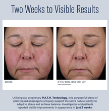 Load image into Gallery viewer, skinbetter Mystro Active Balance Serum / Travel Size
